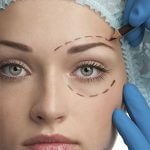 blefaroplastia-cirurgia-plastica-procedimentos-esteticos-giovana-romano-curitiba