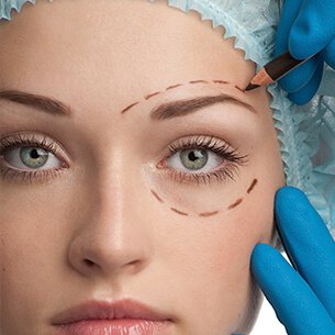 BLEFAROPLASTIA (PÁLPEBRAS)