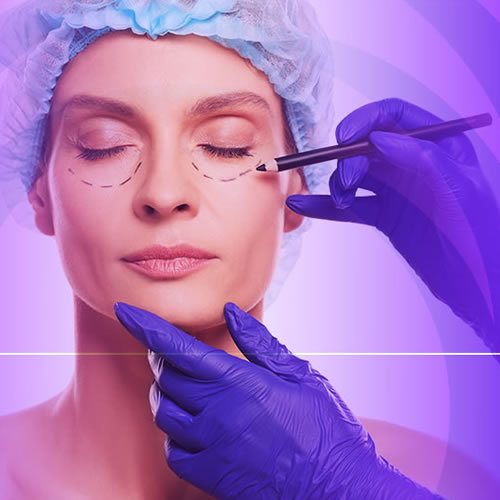 Blefaroplastia-Mobile